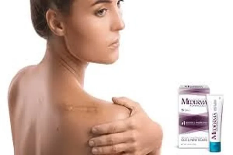 Lines of Strength, Softened with Care: My Stretch Mark Ritual
